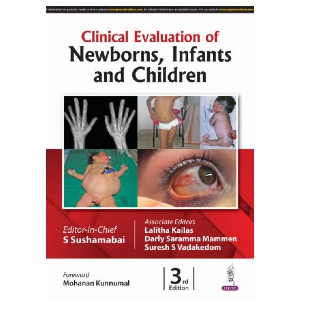 Clinical Evaluation of Newborns, Infants and Children;3rd Edition 2025 by S Sushama Bai, Darly Saramma Mammen & Suresh S Vadakedom