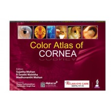 Color Atlas of Cornea;1st Edition 2024 by Sujatha Mohan, R Swathi Nishitha & Madhuvanthi Mohan