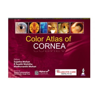 Color Atlas of Cornea;1st Edition 2024 by Sujatha Mohan, R Swathi Nishitha & Madhuvanthi Mohan