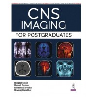 CNS Imaging For Postgraduates;1st Edition 2026 by Hariqbal singh, Mahesh Gautam & Robinson Shrestha