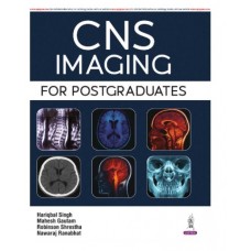 CNS Imaging For Postgraduates;1st Edition 2026 by Hariqbal singh, Mahesh Gautam & Robinson Shrestha