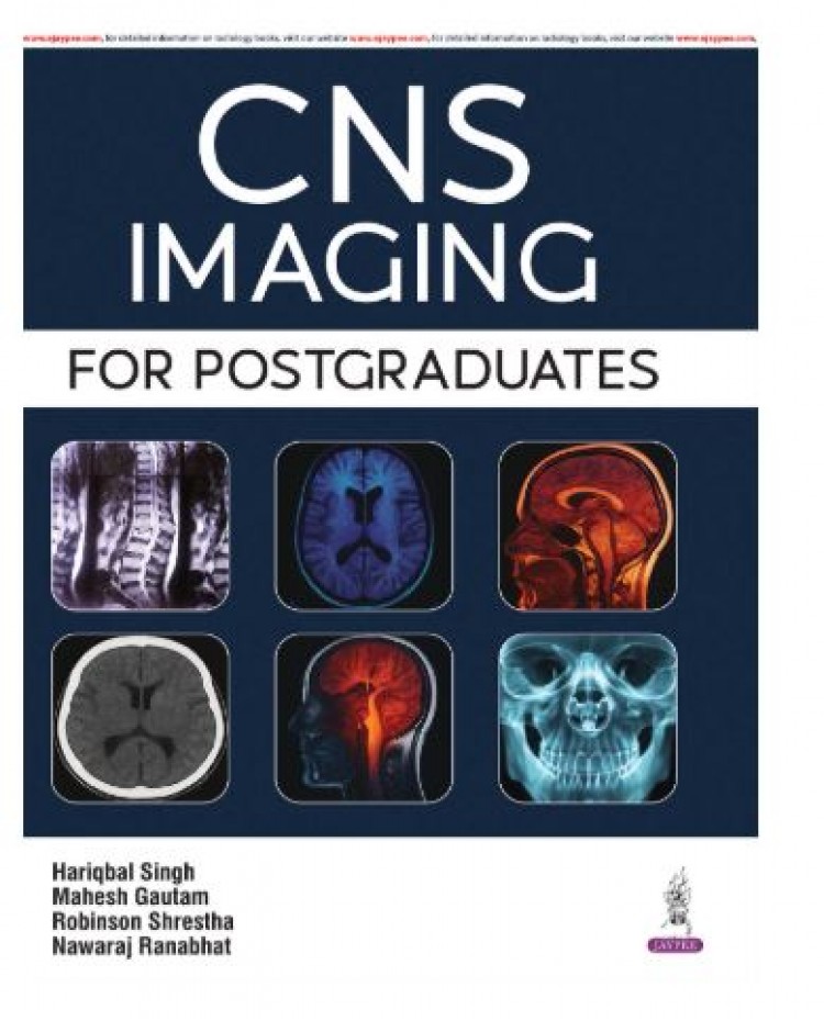 CNS Imaging For Postgraduates;1st Edition 2026 by Hariqbal singh, Mahesh Gautam & Robinson Shrestha