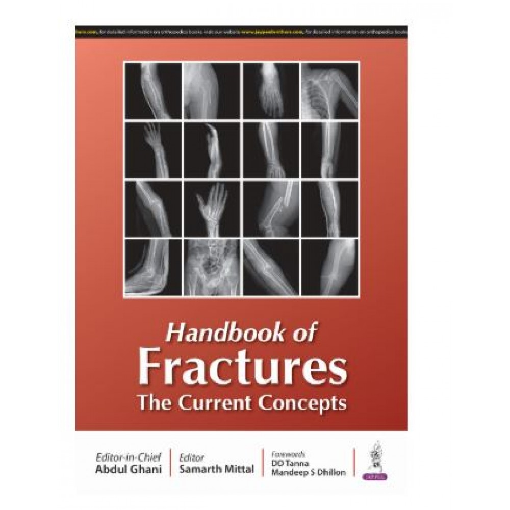 Handbook of Fractures: The Current Concepts;1st Edition 2025 by Samarth Mittal & Abdul Ghani 