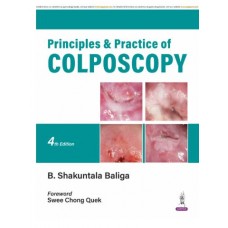 Principles & Practice of Colposcopy;4th Edition 2026 by B Shakuntala Baliga