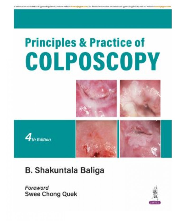 Principles & Practice of Colposcopy;4th Edition 2026 by B Shakuntala Baliga