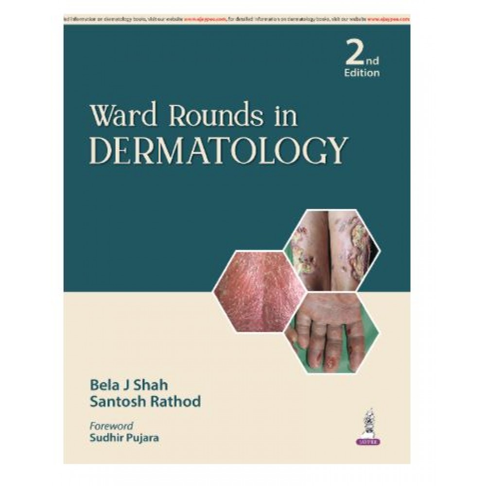 Ward Rounds in Dermatology;2nd Edition 2026 by Bela J Shah & Santosh Rathod