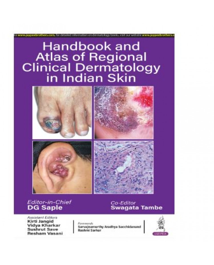 Handbook and Atlas of Regional Clinical Dermatology in Indian Skin;1st Edition 2025 by DG Saples & wagata Tambe