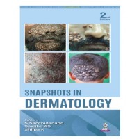 Snapshots in Dermatology;2nd Edition 2026 by S Sacchidanand, Savitha AS & Shilpa K