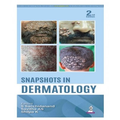 Snapshots in Dermatology;2nd Edition 2026 by S Sacchidanand, Savitha AS & Shilpa K