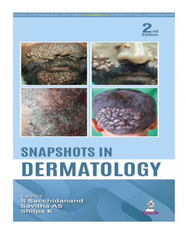 Snapshots in Dermatology;2nd Edition 2026 by S Sacchidanand, Savitha AS & Shilpa K