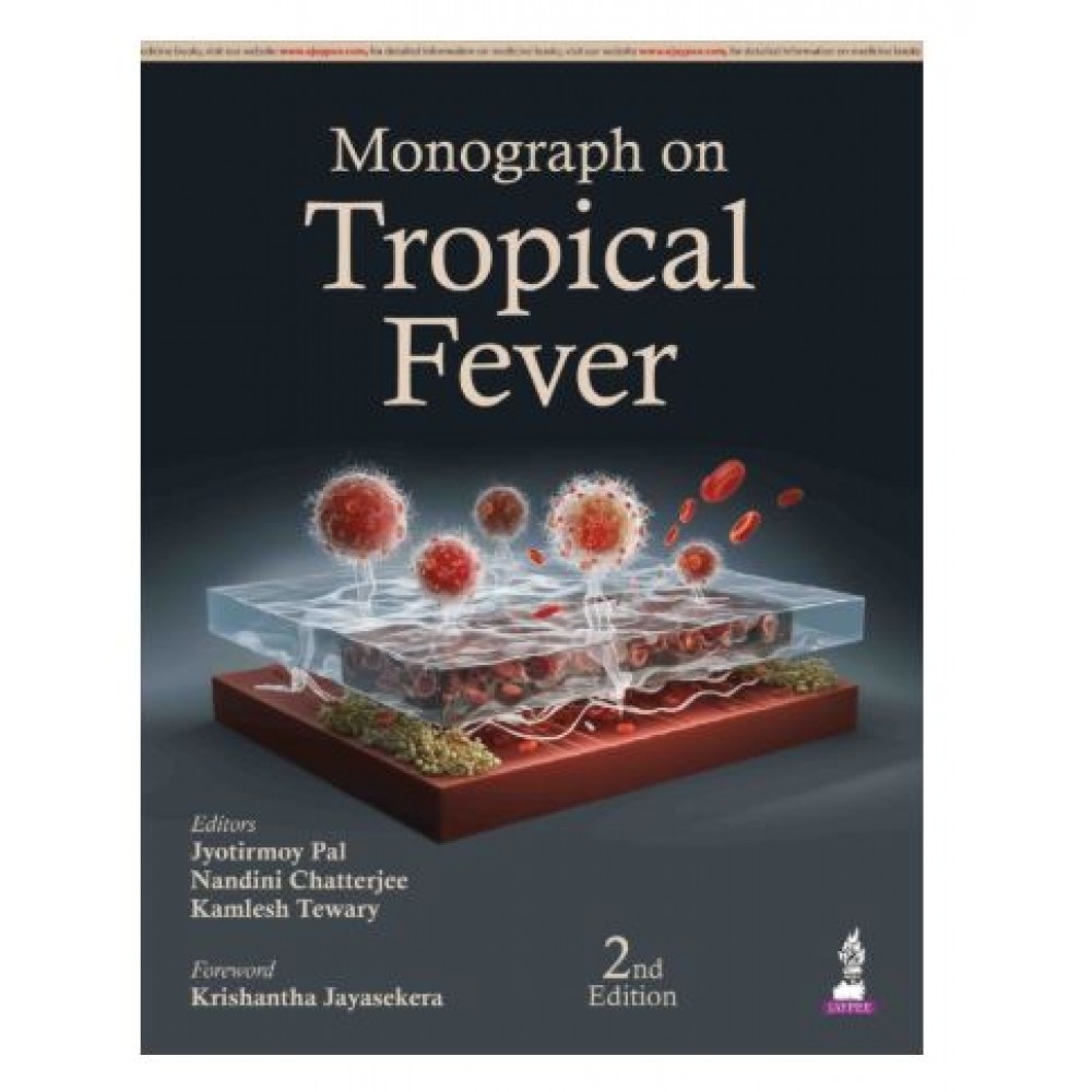 Monograph on Tropical Fever;2nd Edition 2026 by Jyotirmoy Pal, Nandini Chatterjee & kamlesh Tewary