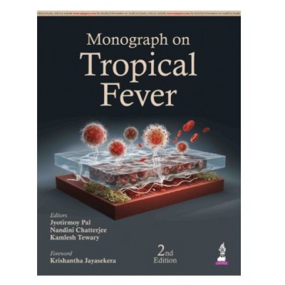 Monograph on Tropical Fever;2nd Edition 2026 by Jyotirmoy Pal, Nandini Chatterjee & kamlesh Tewary