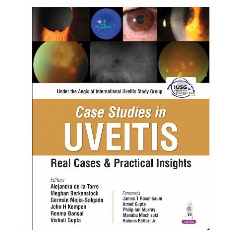 Case Studies in UVEITIS Real Cases and Practical Insights;1st Edition 2026 by Reema Bansal, Vishali Gupta, Alejandra De-La Torre & Meghan Berkenstock
