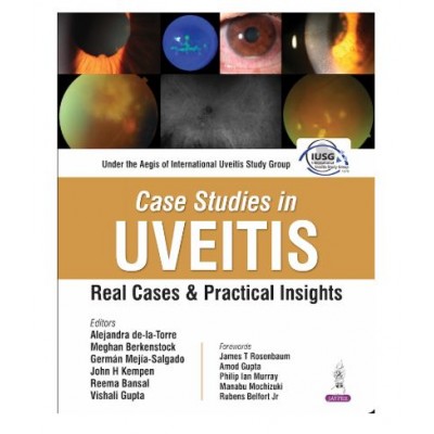 Case Studies in UVEITIS Real Cases and Practical Insights;1st Edition 2026 by Reema Bansal, Vishali Gupta, Alejandra De-La Torre & Meghan Berkenstock