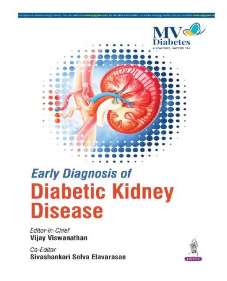 Early Diagnosis of Diabetic Kidney Disease;1st Edition 2026 by Vijay Viswanathan & Sivashankari Selva Elavararasan