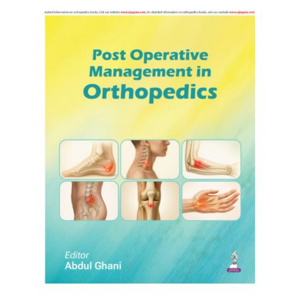 Post Operative Management in Orthopedics;1st Edition 2026 by Abdul Ghani