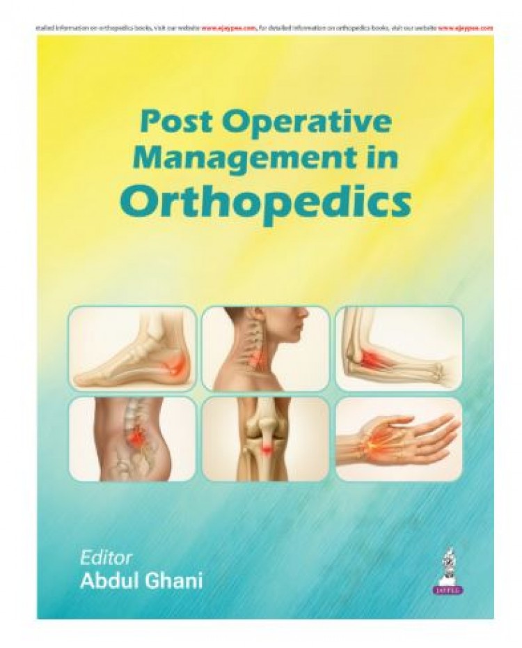 Post Operative Management in Orthopedics;1st Edition 2026 by Abdul Ghani