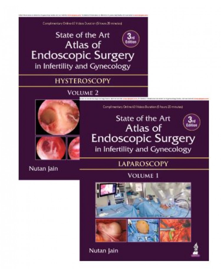 State of the Art Atlas of Endoscopic Surgery in Infertility and Gynecology (2 Volumes);3rd Edition 2026 by Nutan Jain