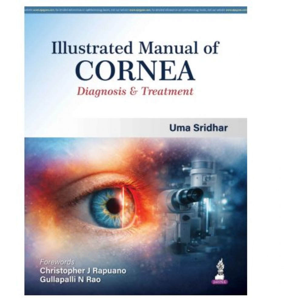 Illustrated Manual of Cornea: Diagnosis & Treatment;1st Edition 2026 by Uma Sridhar