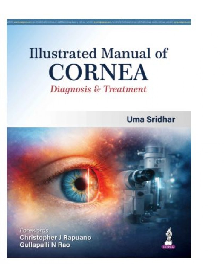 Illustrated Manual of Cornea: Diagnosis & Treatment;1st Edition 2026 by Uma Sridhar