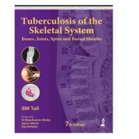 Tuberculosis of the Skeletal System (Bones, Joints, Spine and Bursal Sheaths);7th Edition 2026 by SM Tuli