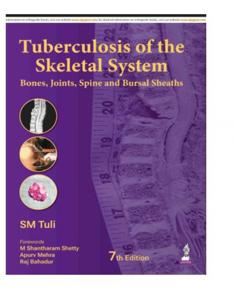 Tuberculosis of the Skeletal System (Bones, Joints, Spine and Bursal Sheaths);7th Edition 2026 by SM Tuli