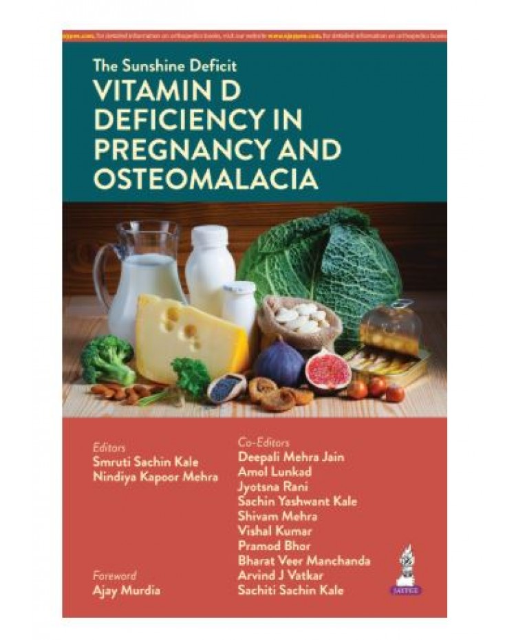 The Sunshine Deficit: Vitamin D Deficiency in Pregnancy and Osteomalacia;1st Edition 2026 by Smruti Sachin Kale & Nindiya Kapoor Mehra