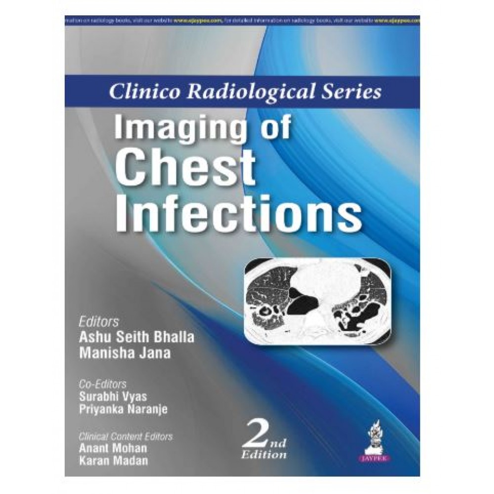 Clinico Radiological Series: Imaging of Chest Infections;2nd Edition 2026 by Ashu Seith Bhalla & Manisha Jana