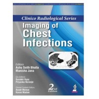Clinico Radiological Series: Imaging of Chest Infections;2nd Edition 2026 by Ashu Seith Bhalla & Manisha Jana