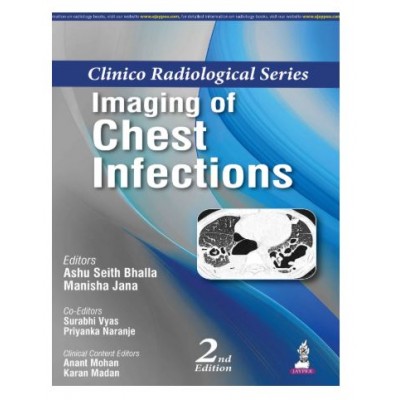 Clinico Radiological Series: Imaging of Chest Infections;2nd Edition 2026 by Ashu Seith Bhalla & Manisha Jana