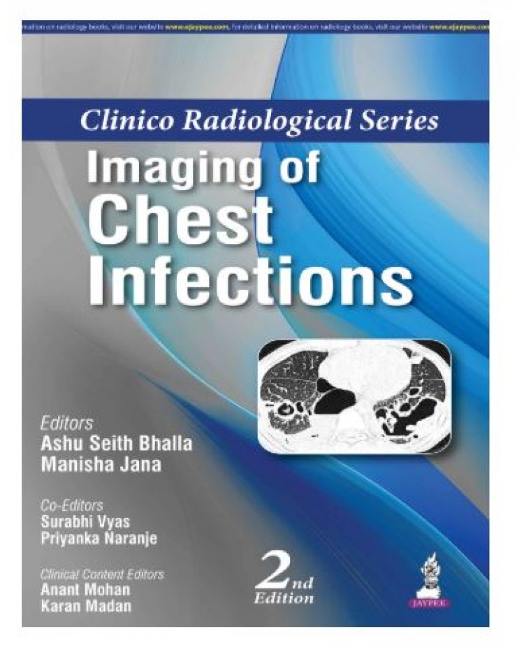 Clinico Radiological Series: Imaging of Chest Infections;2nd Edition 2026 by Ashu Seith Bhalla & Manisha Jana