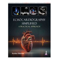 Echocardiography Simplified (A Practical Approach);1st Edition 2027 by Keshav Sharma
