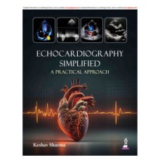 Echocardiography Simplified (A Practical Approach);1st Edition 2027 by Keshav Sharma