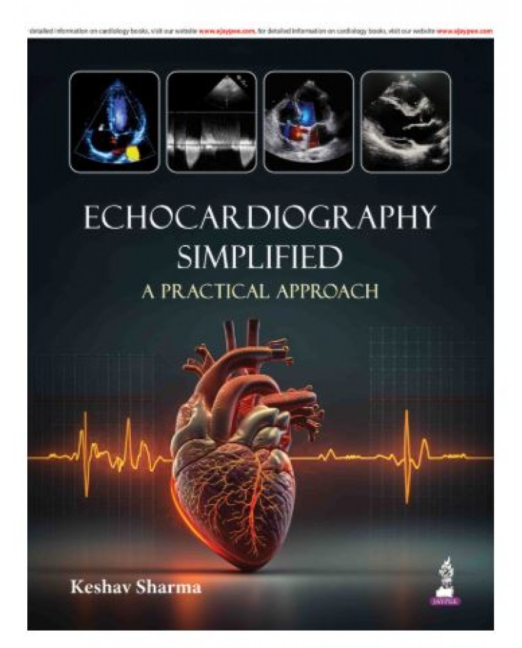 Echocardiography Simplified (A Practical Approach);1st Edition 2027 by Keshav Sharma