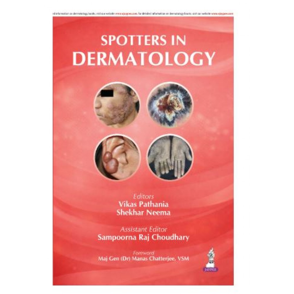 Spotters in Dermatology;1st Edition 2026 by Vikas Pathania, Shekhar Neema & Sampoorna Raj Choudhary
