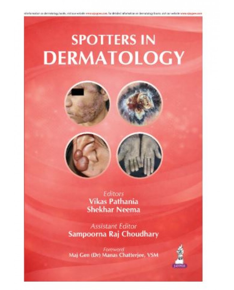 Spotters in Dermatology;1st Edition 2026 by Vikas Pathania, Shekhar Neema & Sampoorna Raj Choudhary