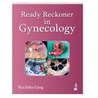 Ready Reckoner in Gynecology;1st Edition 2026 by Ruchika Garg