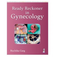 Ready Reckoner in Gynecology;1st Edition 2026 by Ruchika Garg