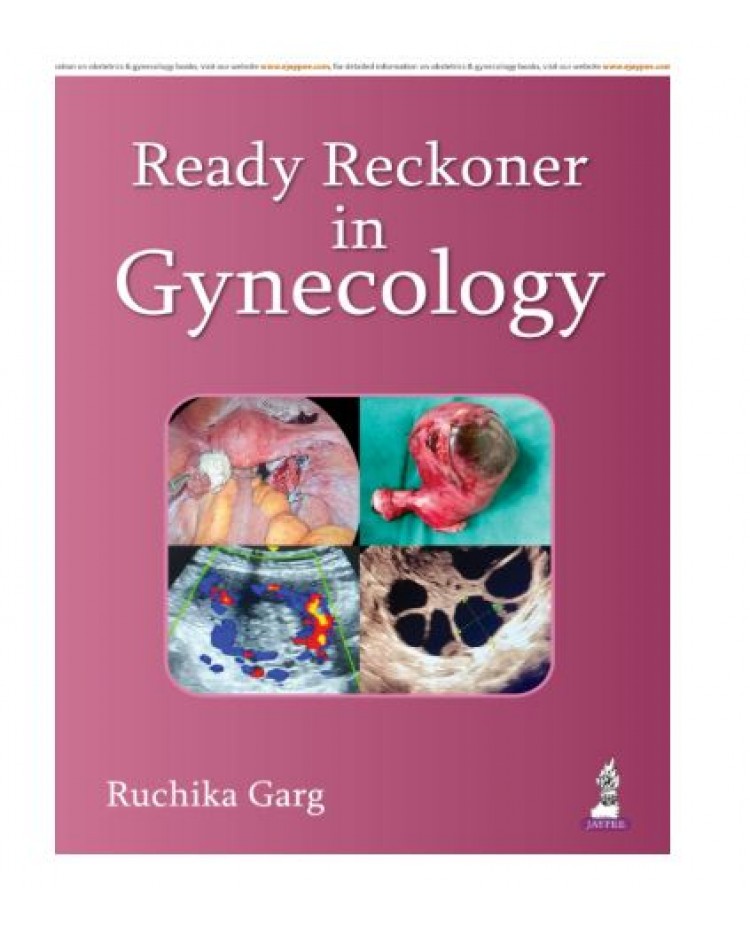 Ready Reckoner in Gynecology;1st Edition 2026 by Ruchika Garg