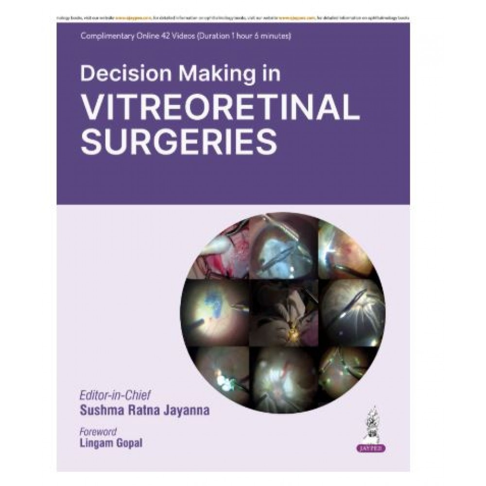 Decision Making in Vitreoretinal Surgeries;1st Edition 2026 by Sushma Ratna Jayanna