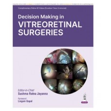 Decision Making in Vitreoretinal Surgeries;1st Edition 2026 by Sushma Ratna Jayanna