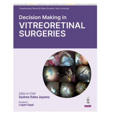 Decision Making in Vitreoretinal Surgeries;1st Edition 2026 by Sushma Ratna Jayanna