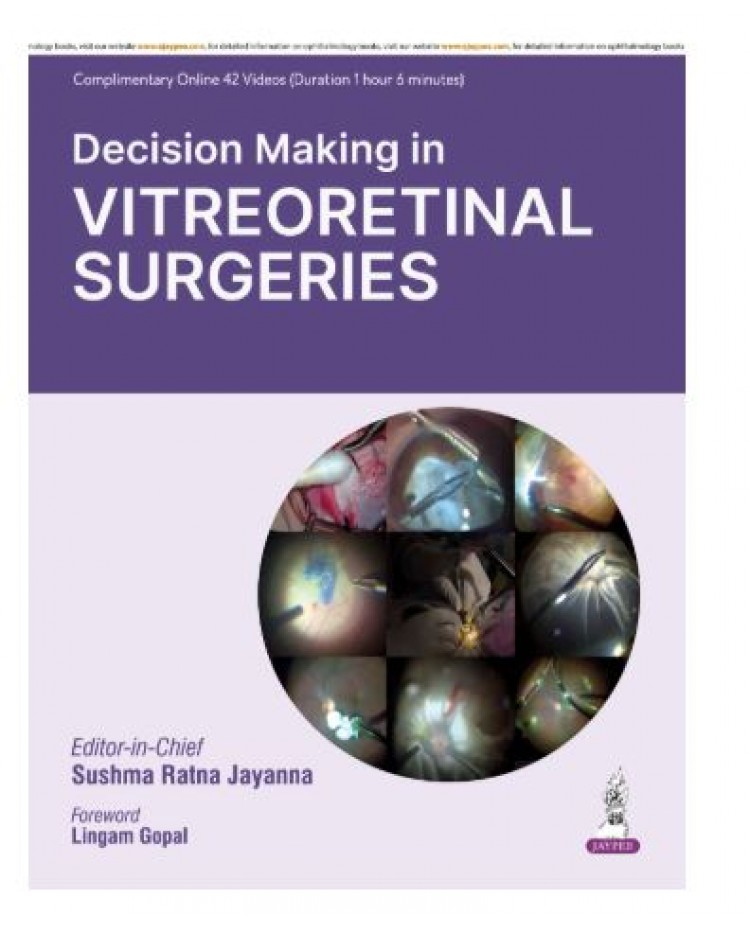 Decision Making in Vitreoretinal Surgeries;1st Edition 2026 by Sushma Ratna Jayanna