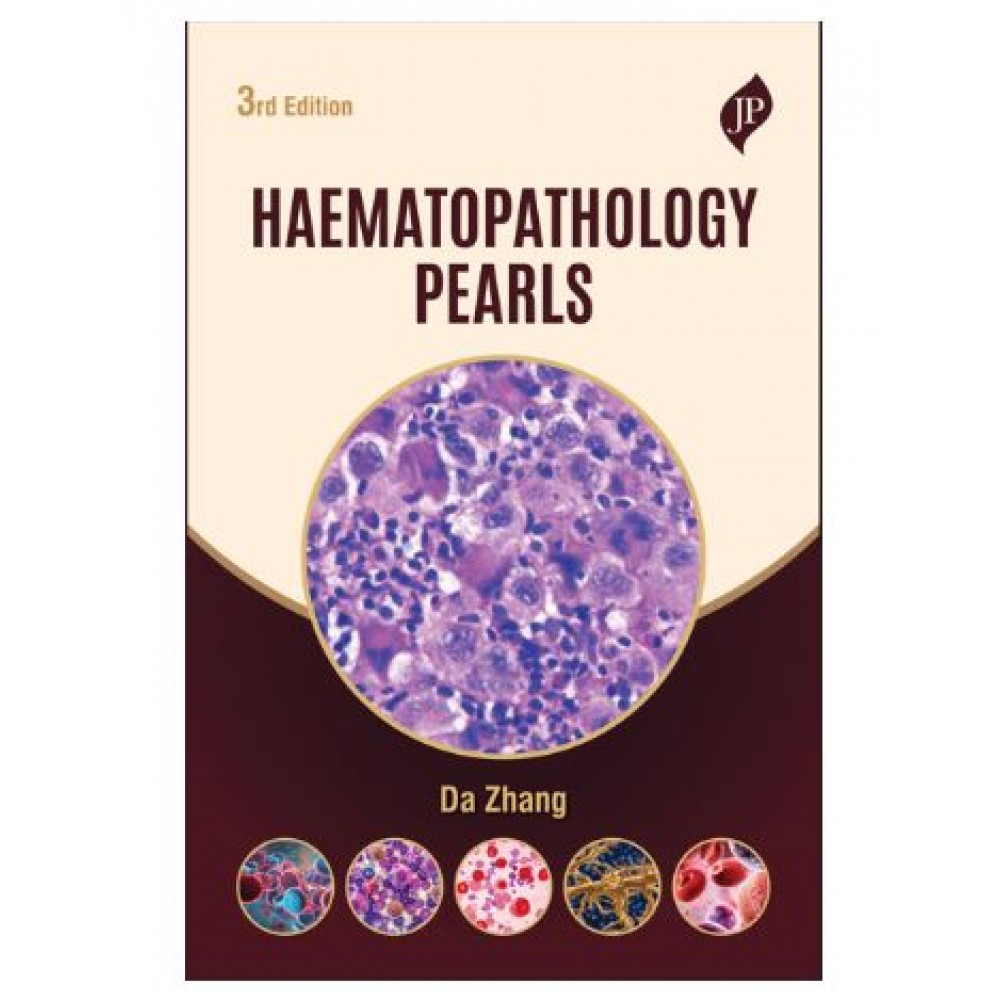 Haematopathology Pearls;Board Review for Pathology Residents, Fellows and Medical Students;3rd Edition 2027 by DA Zhang