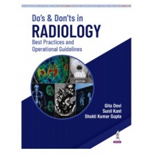 Do’s and Don’ts in Radiology: Best Practices and Operational Guidelines for Radiologists and Healthcare Administrators;1st Edition 2027 by Gita Devi, Sunil Kant & Shakti Kumar Gupta