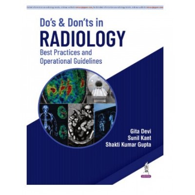 Do’s and Don’ts in Radiology: Best Practices and Operational Guidelines for Radiologists and Healthcare Administrators;1st Edition 2027 by Gita Devi, Sunil Kant & Shakti Kumar Gupta