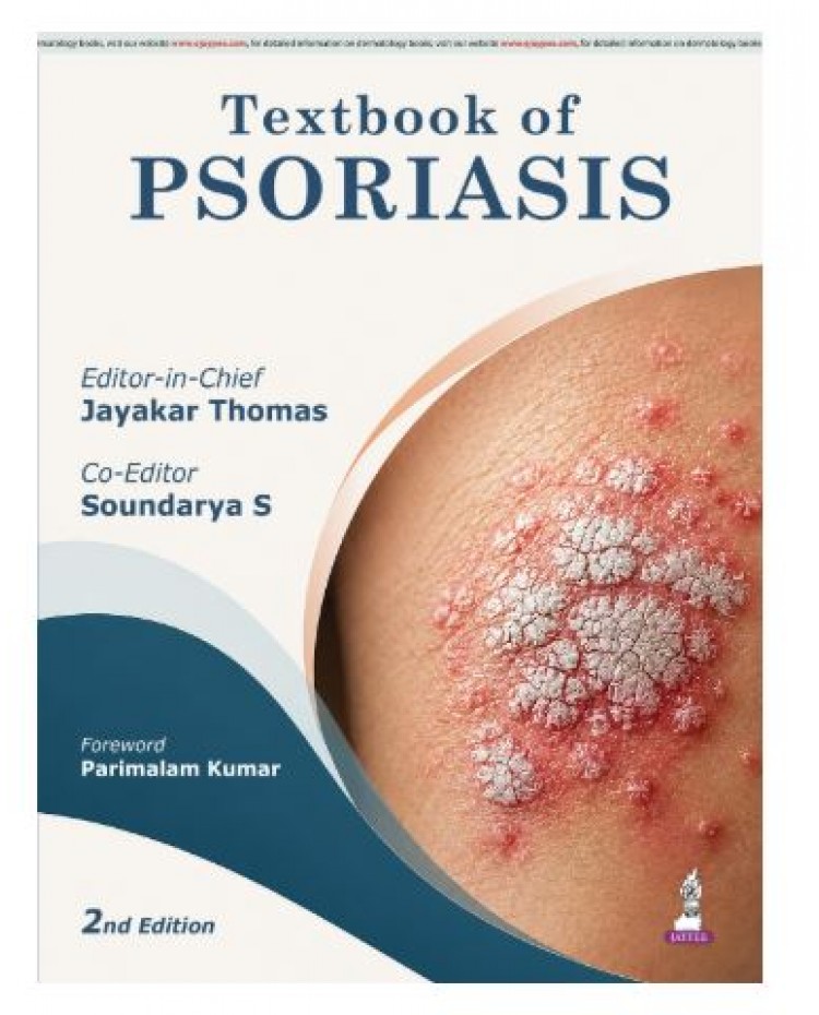 Textbook of Psoriasis for Dermatology Postgraduates and Practicing Dermatologists;2nd Edition 2027 by Jayakar Thomas