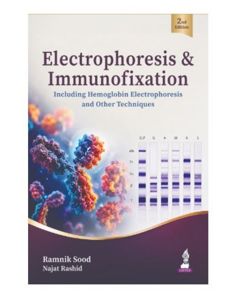 Electrophoresis & Immunofixation for Pathologists and PG Pathology Students;2nd Edition 2027 by Ramnik Sood & Najat Rashid