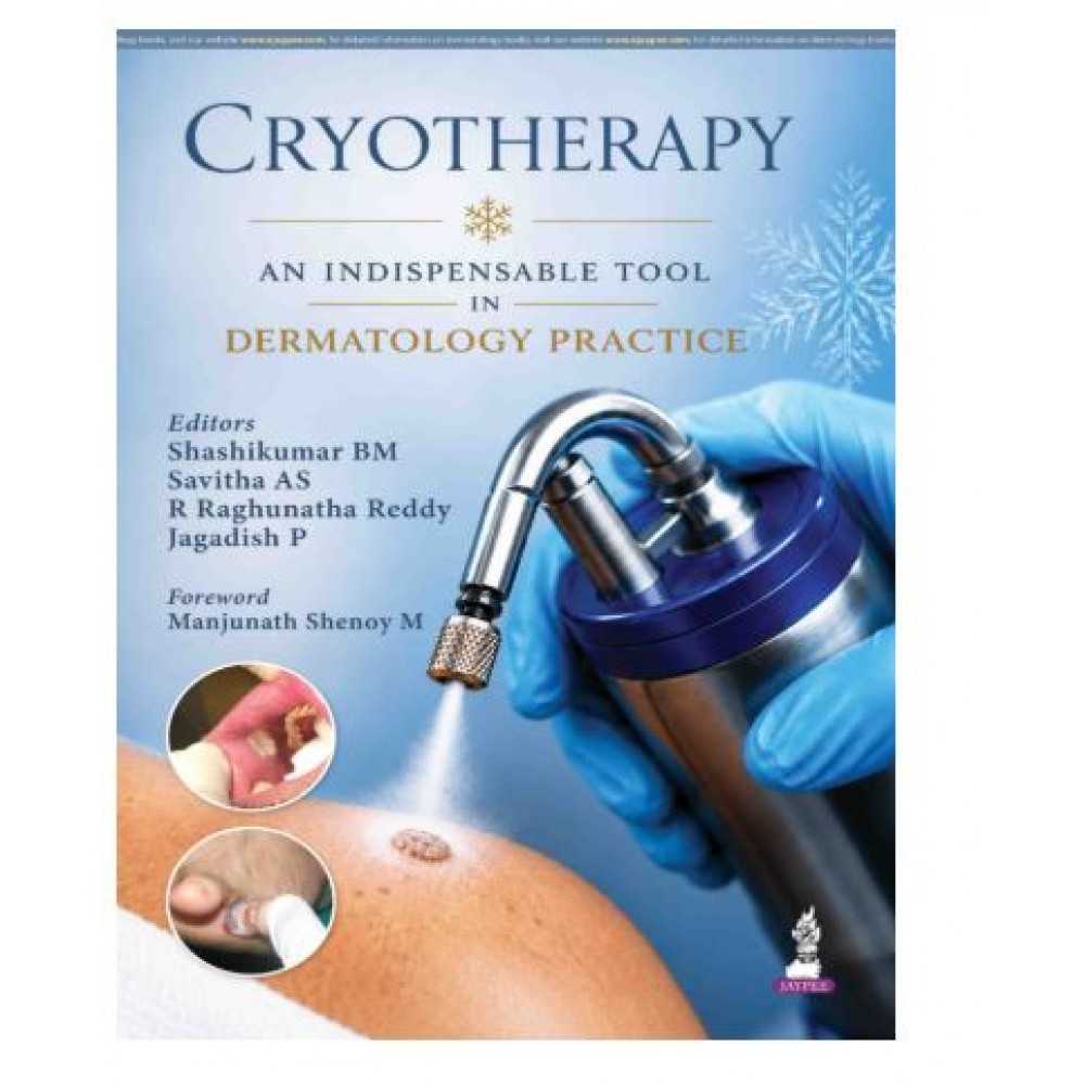 Cryotherapy: An Indispensable Tool in Dermatology Practice;1st Edition 2027 by Shashikumar BM, Savitha AS, R Raghunatha Reddy & Jagadish P