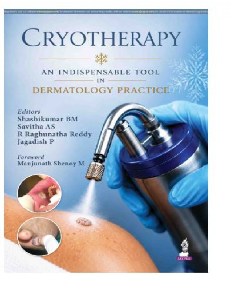 Cryotherapy: An Indispensable Tool in Dermatology Practice;1st Edition 2027 by Shashikumar BM, Savitha AS, R Raghunatha Reddy & Jagadish P